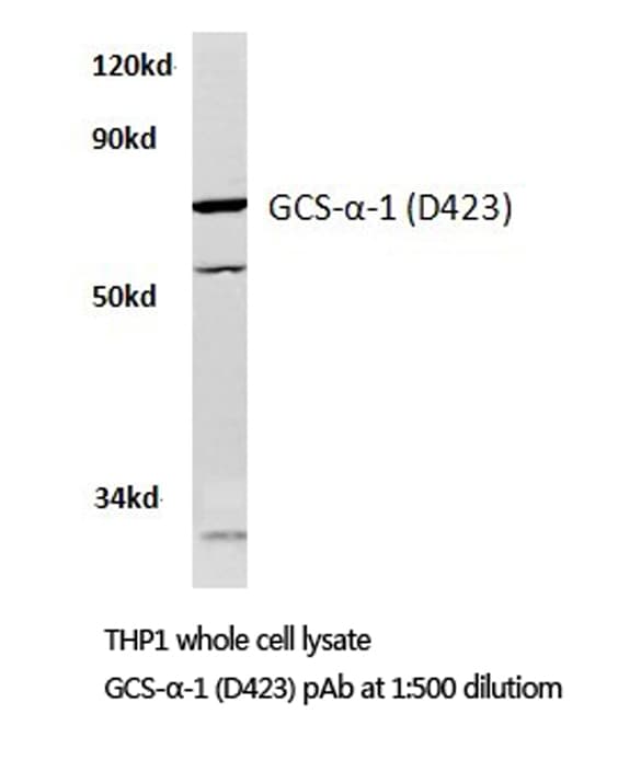 GUCY1A1 / GUCY1A3 Antibody (Asp423)