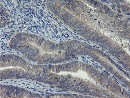 Monoclonal Mouse anti-Human COMMD1 Antibody (clone OTI1C3, IHC, WB)