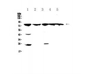 ADRBK1 / GRK2 Antibody
