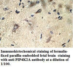 PIP4K2A / PIPK Antibody (aa21-278)