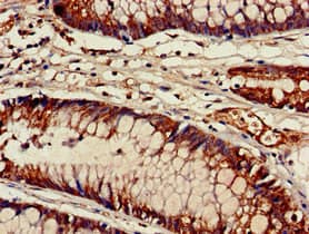 ACAD9 Antibody