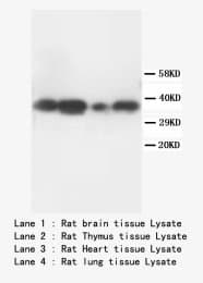 TNFAIP1 Antibody (N-Terminus)
