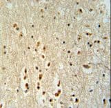 PTOV1 Antibody (aa25-52)