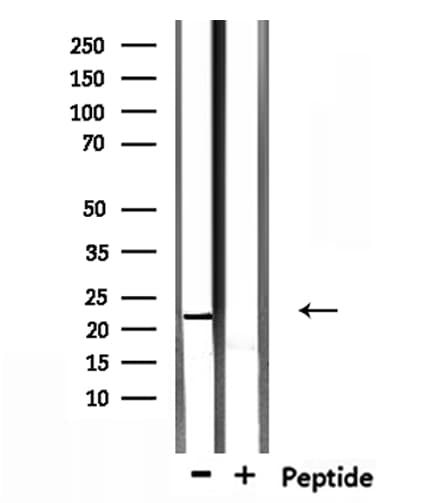 TCEAL5 Antibody
