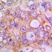 CASP1 / Caspase 1 Antibody (Internal)