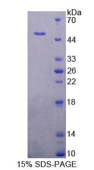 Human PUS1 Protein (Recombinant His-T7)