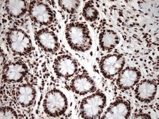 Monoclonal Mouse anti-Human TRIM28 / KAP1 Antibody (clone OTI5E10, IHC, IF, WB)