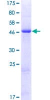Human HSPC133 / METTL5 Protein (Recombinant GST)