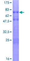 Human NEUROD1 Protein (Recombinant GST)