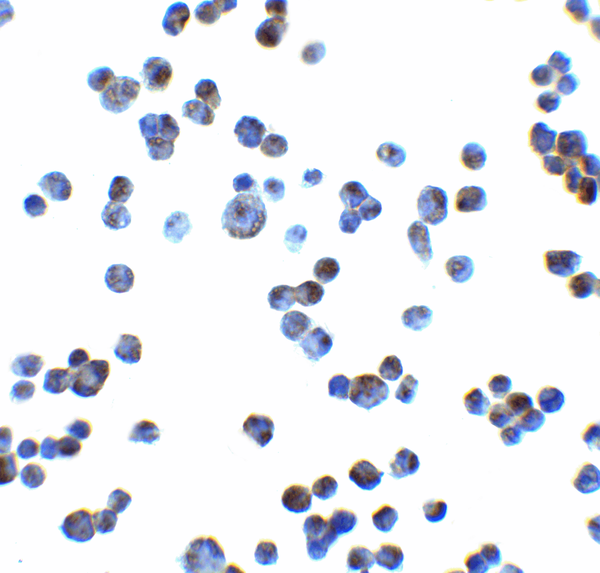 IHC-plus™ NKG2DL4 / ULBP4 Antibody