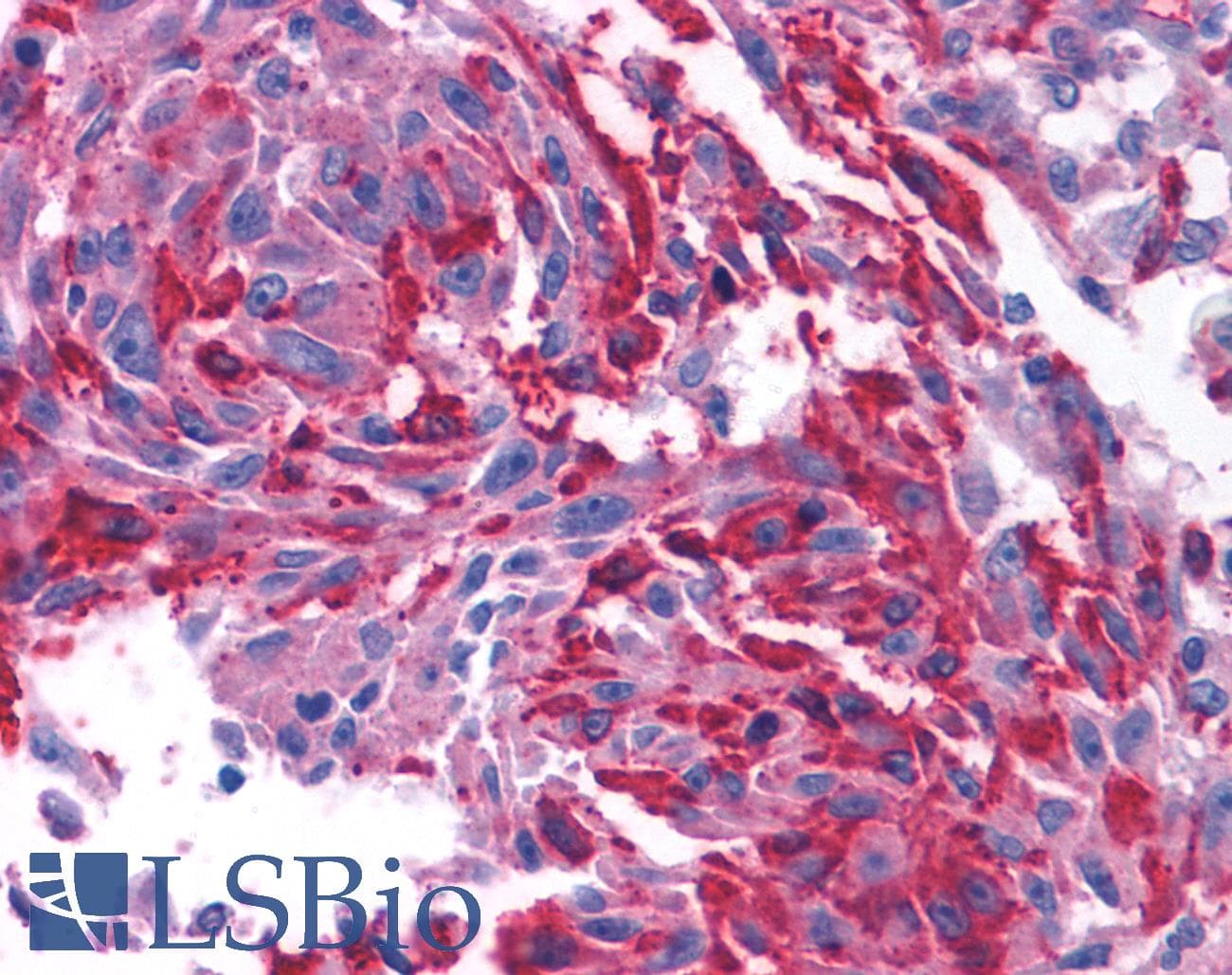 PathPlus™ CRFR1 / CRHR1 Antibody (N-Terminus)