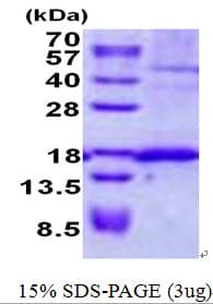 Human SSR4 Protein (Recombinant His)