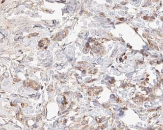SKP2 Antibody