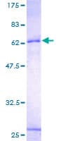 Human INHBE / Activin Protein (Recombinant GST)