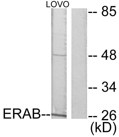 HSD17B10 / HADH2 Antibody (aa111-160)