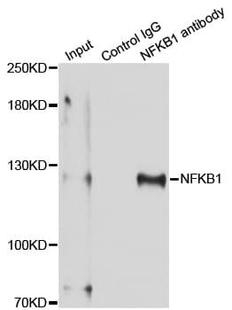 NFKB1 / NF-Kappa-B Antibody