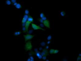 MAPK13 / p38delta Antibody (clone OTI2G5)