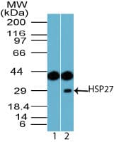 IHC-plus™ Polyclonal Rabbit anti-Human HSPB1 / HSP27 Antibody (aa50-100, IHC, WB)