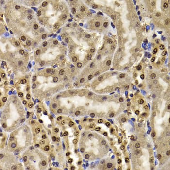 Polyclonal Rabbit anti-Human HIRIP3 Antibody (IHC, IF, WB)
