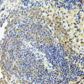 Polyclonal Rabbit anti-Human RIP1 / RALBP1 Antibody (IHC, WB)
