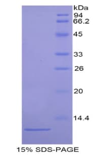 Mouse ARPC4 Protein (Recombinant His)