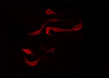 Polyclonal Rabbit anti-Human MAPK8IP2 / JIP2 Antibody (IHC, IF, WB)