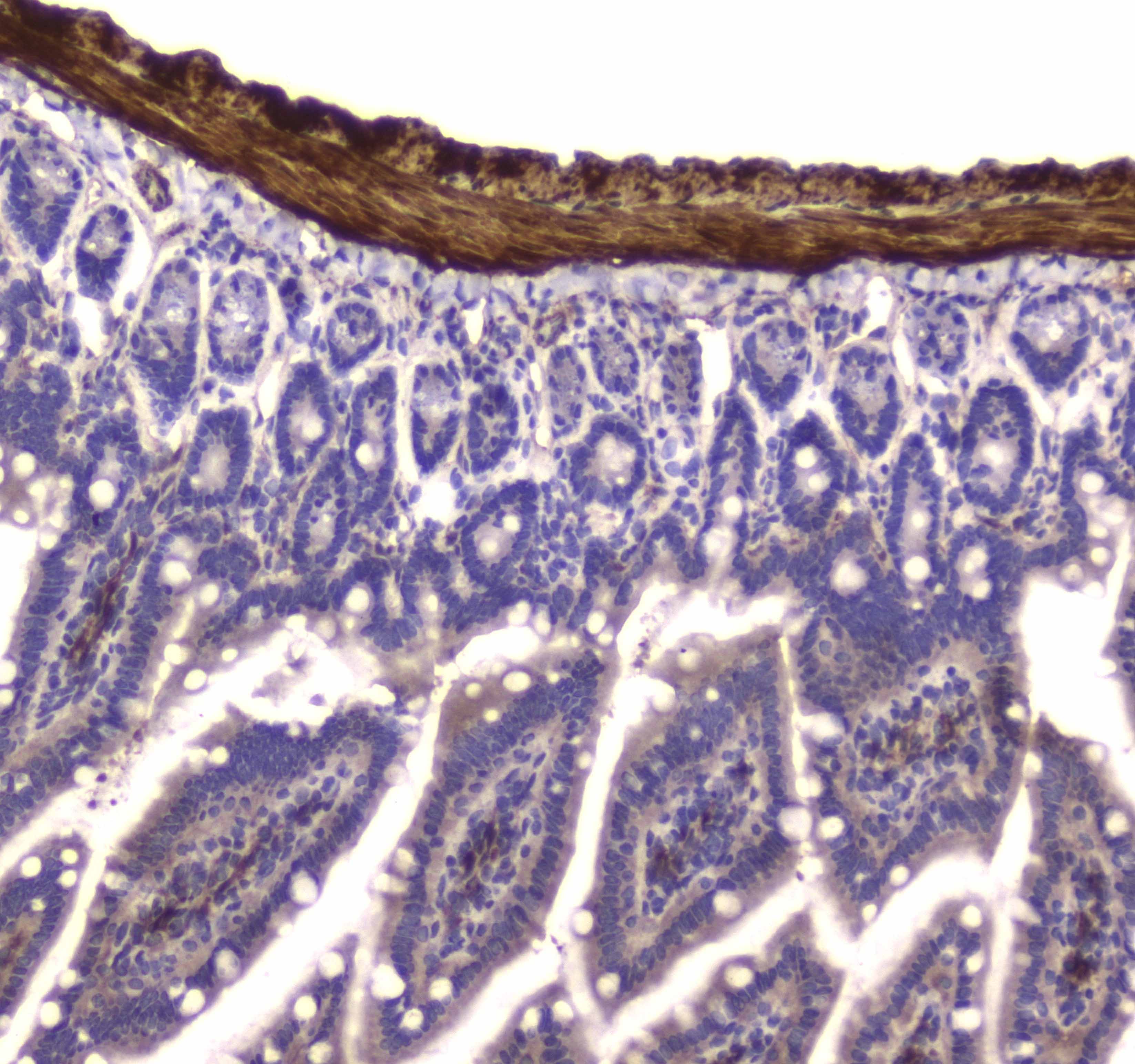 MYLK Antibody