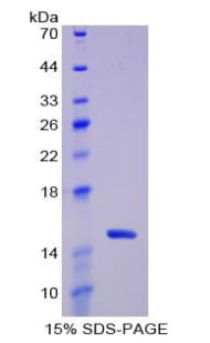 Rat TXN / Thioredoxin / TRX Protein (Recombinant His)
