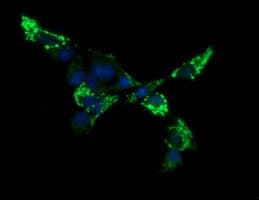 IHC-plus™ ACAA2 Antibody (clone 1C10)