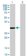 FCN1 / Ficolin-1 Antibody (clone 2B7)