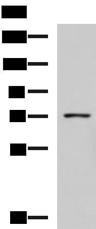 GUSB / Beta Glucuronidase Antibody