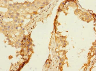 Polyclonal Rabbit anti-Human NTM / Neurotrimin Antibody (IHC, WB)