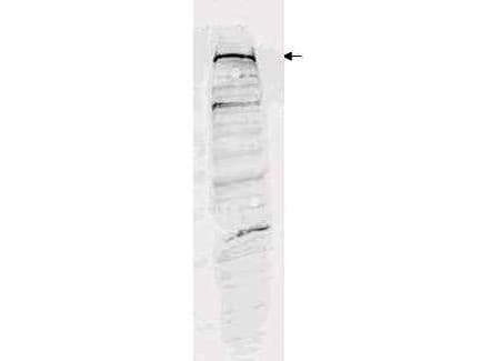 IHC-plus™ ESET / SETDB1 Antibody