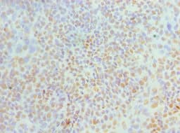 Polyclonal Rabbit anti-Human MCM6 Antibody (aa562-821, IHC)