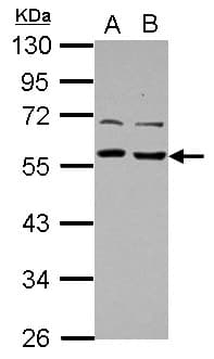 TOM1L1 Antibody (Internal)