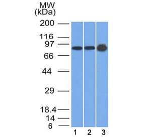 Monoclonal Mouse anti-Human PKP1 / Plakophilin 1 Antibody (clone 10B2, Azide-free,BSA-free, IF, WB)