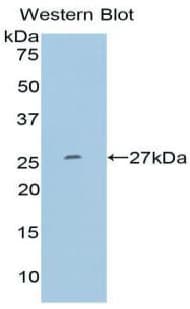 MMP11 Antibody (aa277-489, Biotin)