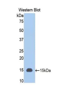 PIGR Antibody (aa343-447)