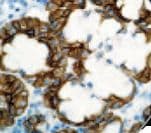 Monoclonal Mouse anti-Human Basic Cytokeratin AE3 Antibody (clone AE3, Ready-to-Use, IHC)