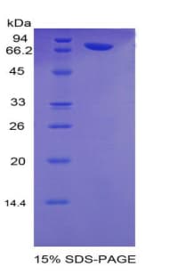 Human PLAA Protein (Recombinant His-MBP)