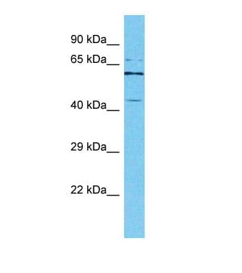 IPMK Antibody (aa188-237)