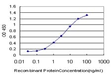 Monoclonal Mouse anti-Human ABL2 Antibody (clone 5C6, IF, WB)
