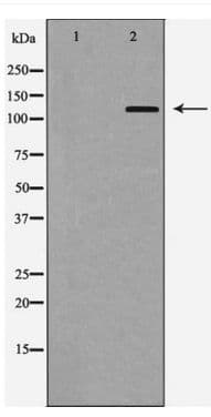 ITGAE / CD103 Antibody