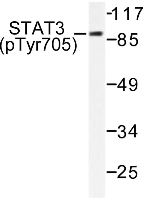 Polyclonal Rabbit anti-Human STAT3 Antibody (phospho-Tyr705, IHC, WB)