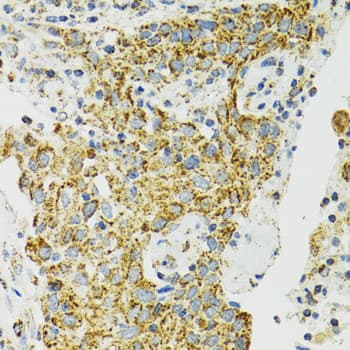 Polyclonal Rabbit anti-Human HSPA9 / Mortalin / GRP75 Antibody (IHC, IF, WB)
