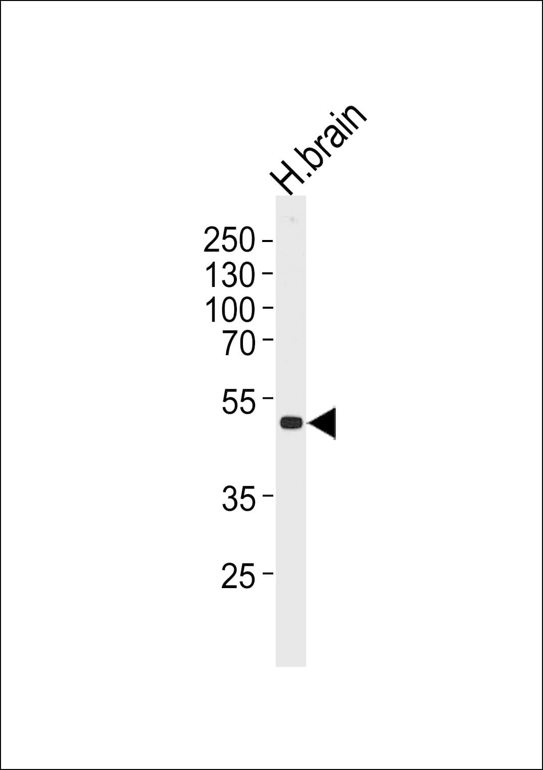 KCNJ12 / Kir2.2 Antibody (aa405-433)