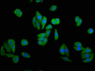 GAK Antibody