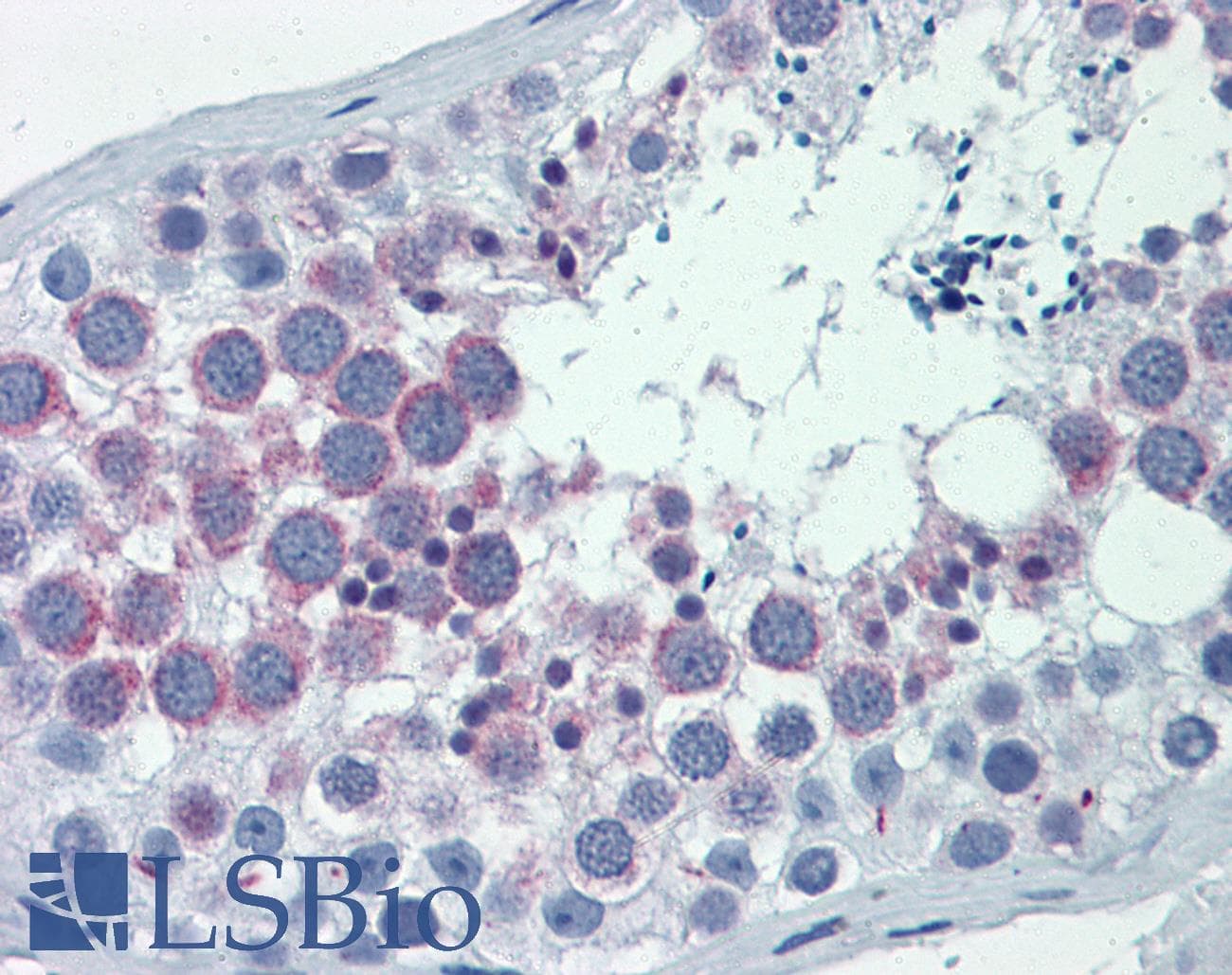 IHC-plus™ HURP / DLGAP5 Antibody (aa791-840)
