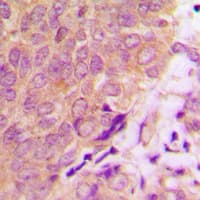 CASP6 / Caspase 6 Antibody (C-Terminus)