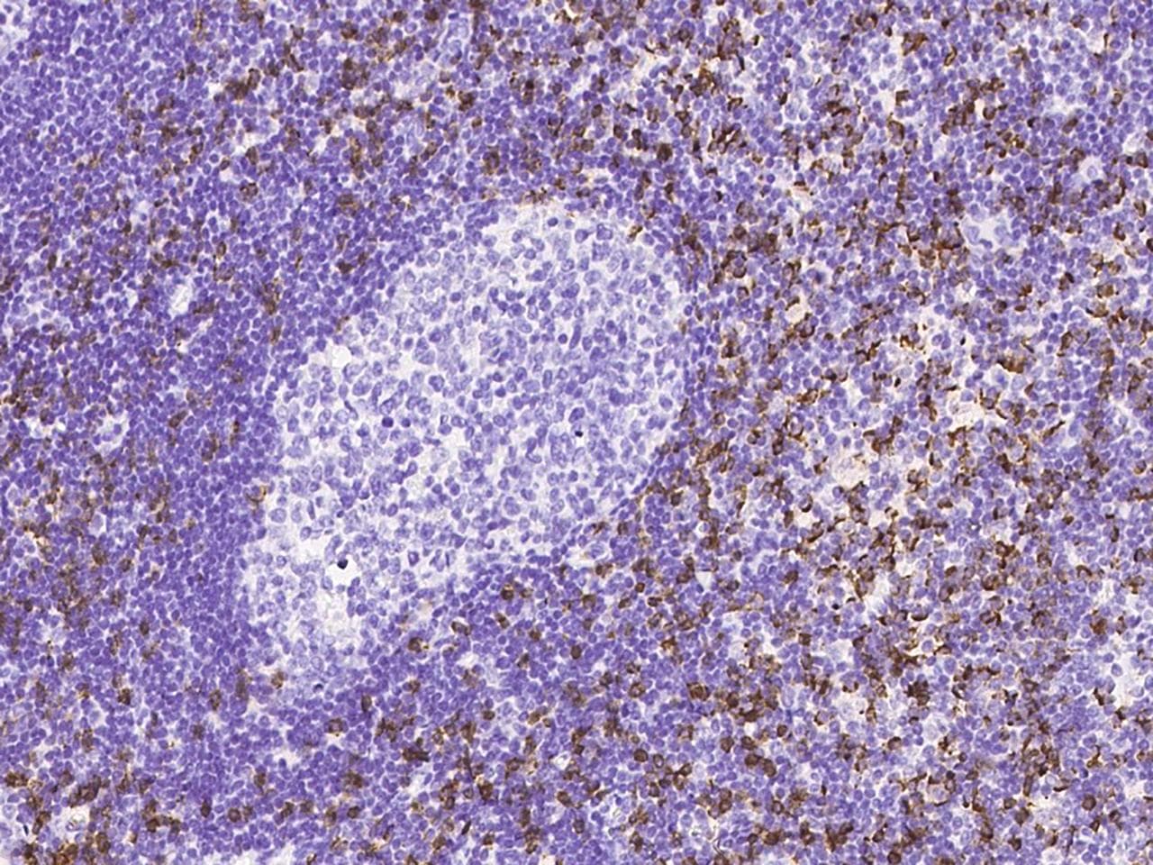 CD8A / CD8 Alpha Antibody (Preservative Free)